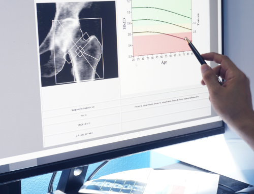 Understanding Your Bone Density – What are T-Scores and Z-Scores
