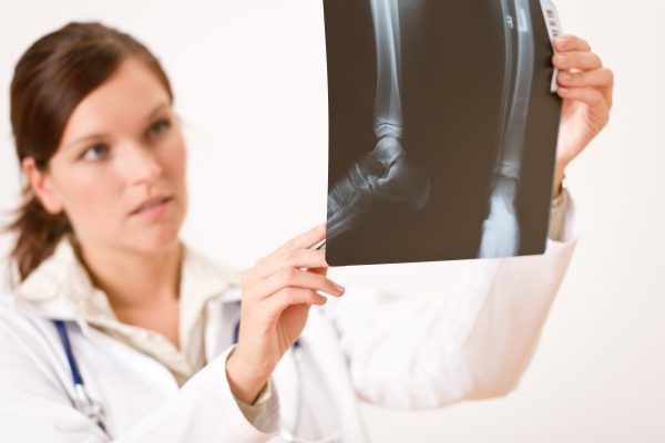 Understanding Bone Mineral Density (BMD)