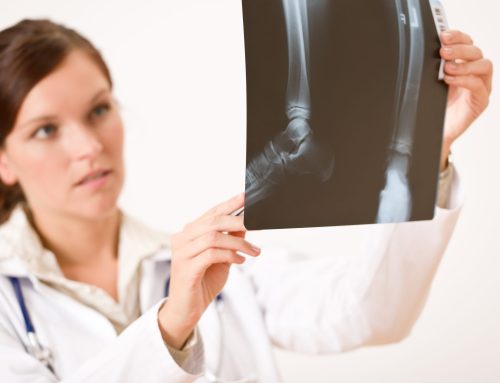 Bone Mineral Density (BMD): Understanding the Medical Abbreviation and Its Significance
