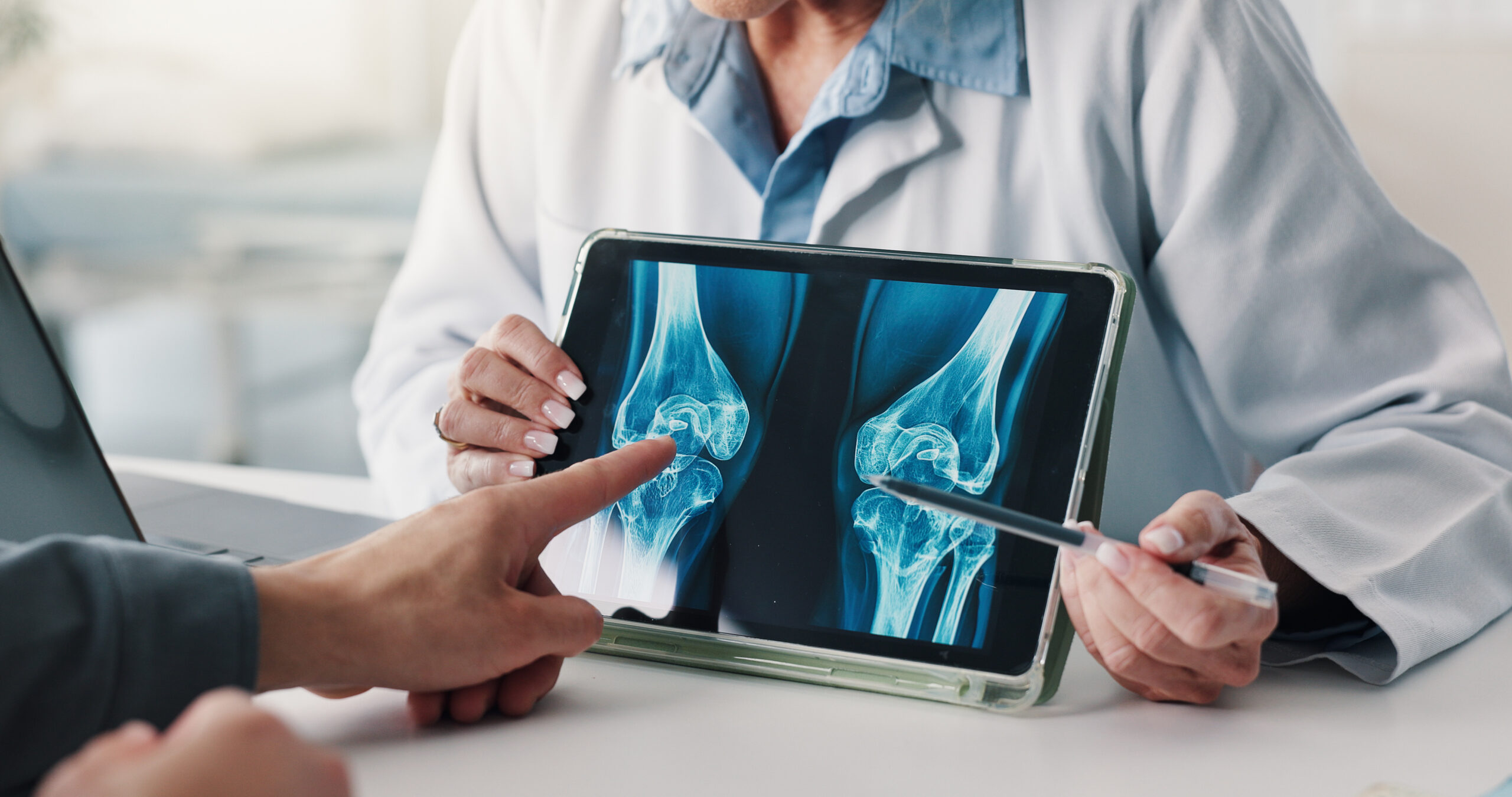 bone density xray